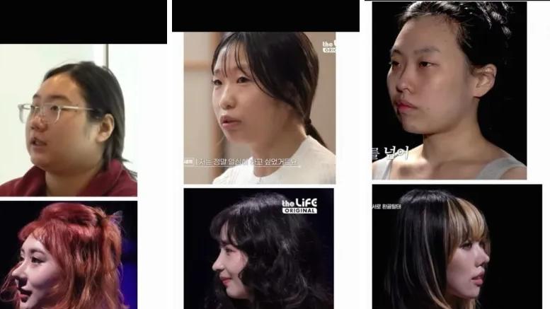 韩娱整容救世主变屠夫？《成为女孩》70%参与者术前完美！术后鼻梁歪成‘匹诺曹’