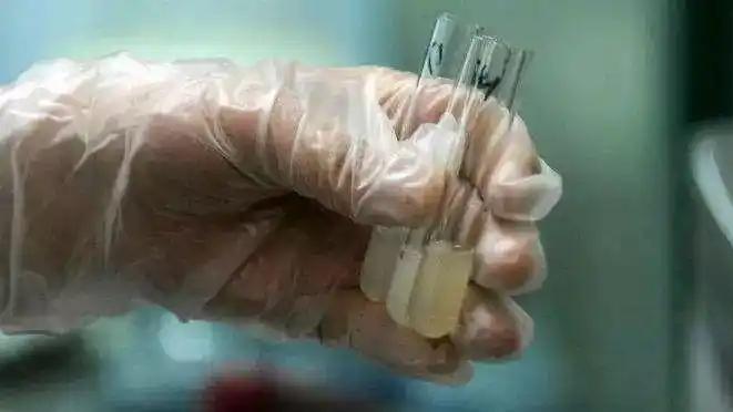 试管婴儿前要做的检查，你都做好了吗？