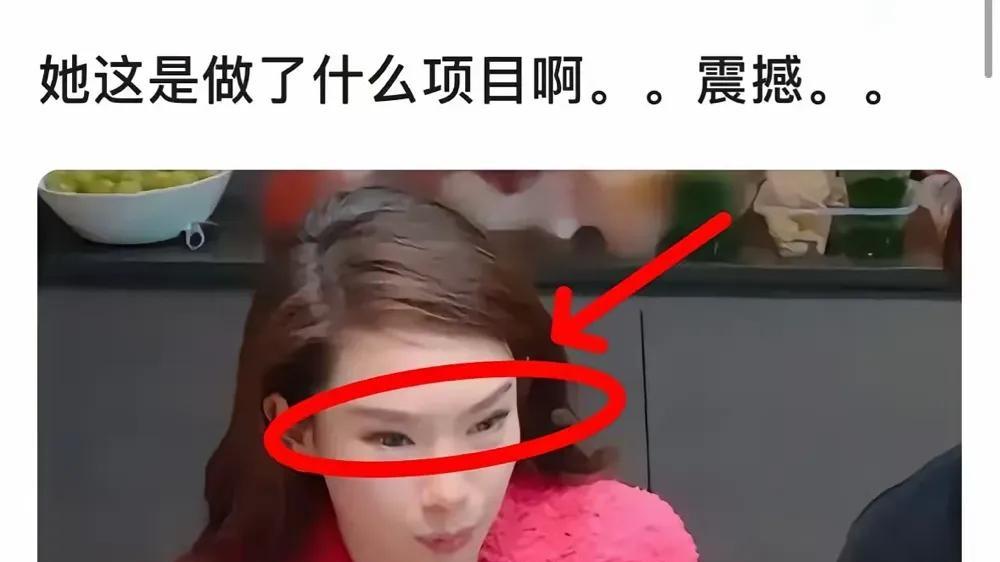 戚薇眼角变形是角度和表情问题



戚薇眼角怎么了？不会真有人相信是整坏了吧？拜