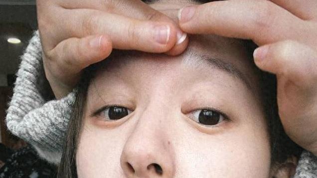 赵露思公开承认曾遭殴打、患上抑郁症，长文揭更多内幕