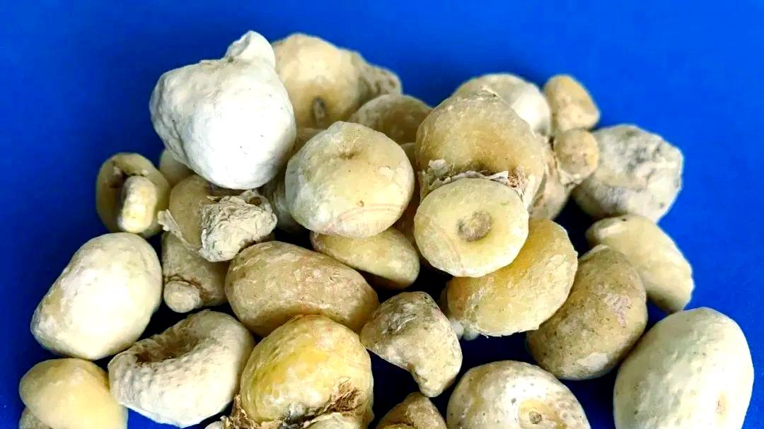 爱长囊肿的人，身体常有3种邪气，重用5味药驱邪，包块消得快