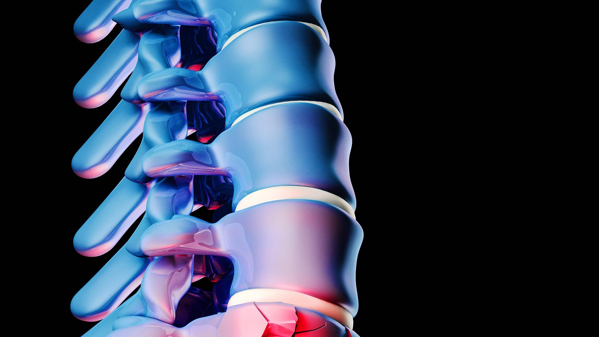 南宁城和医院分享腰椎间盘突出微创手术后的保养