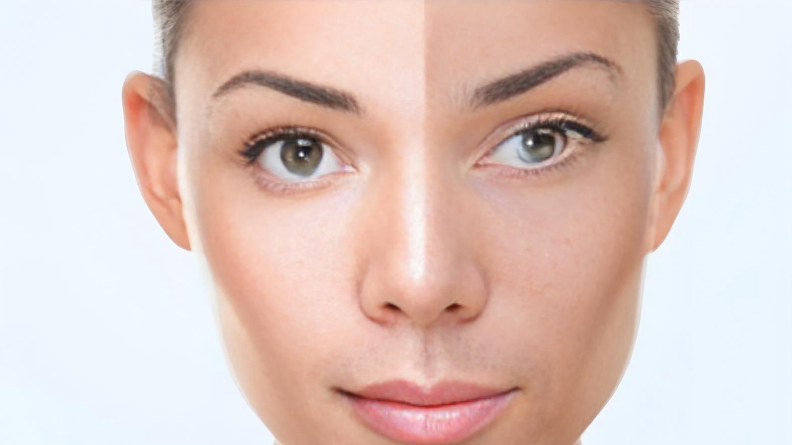 光子嫩肤后反黑？选对修复产品是关键！可复美与伊美时代黄金组合