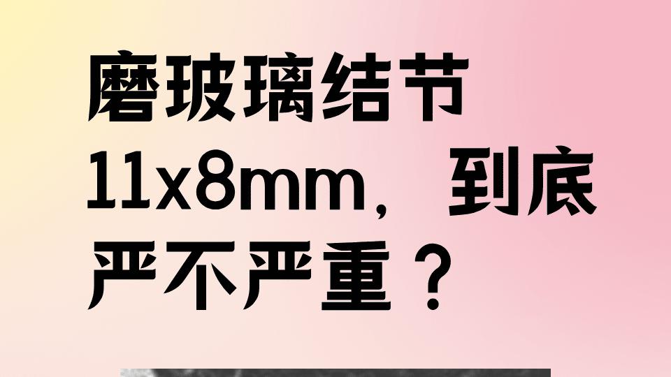 肺结节，除了复查CT，还有四种最前沿的高科技检测良恶性？