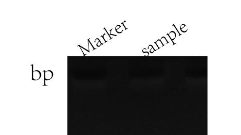 5mC RIP-报告（RNA甲基化m5C)