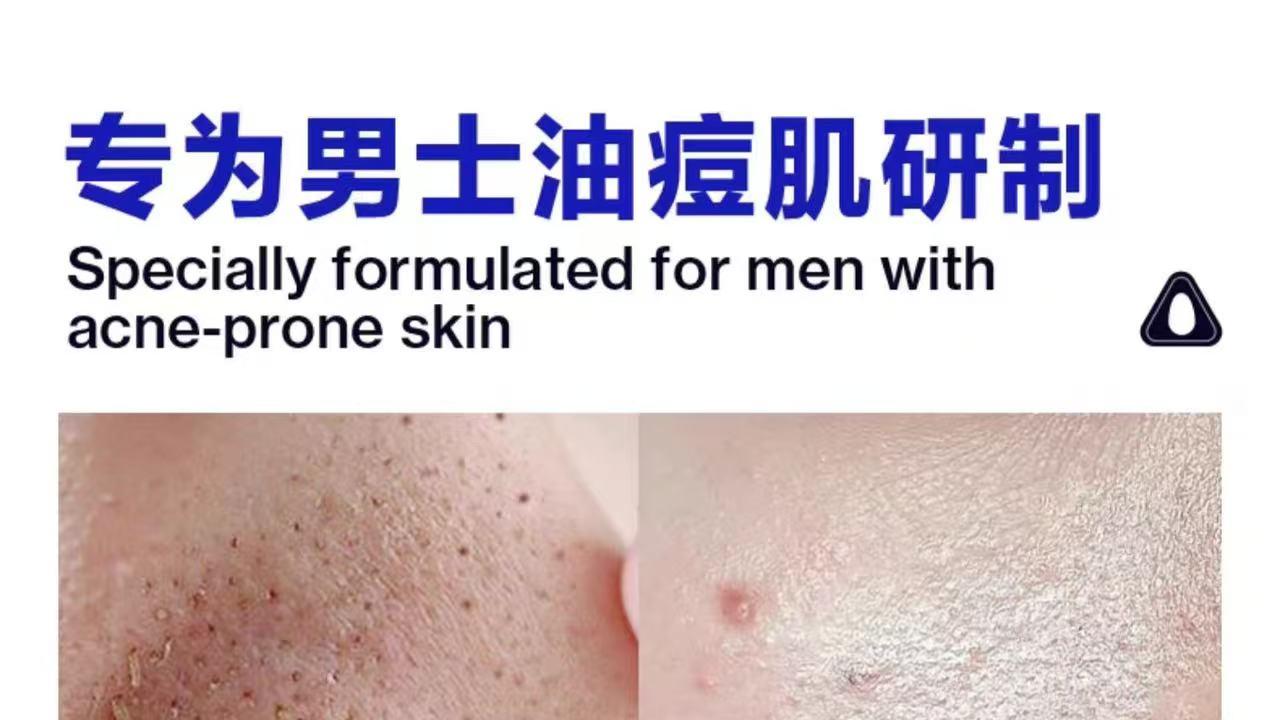 2025 男士洗面奶控油清爽推荐：双氨基酸复配温和清洁告别油光