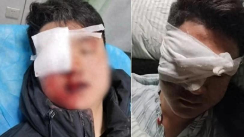燃放烟花一时爽，事后受伤泪两行：是谁偷走他的光明？