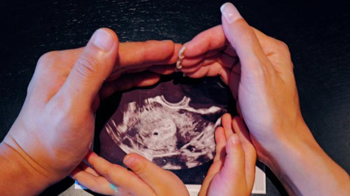 卢靖姗晒一家三口捧 B 超照，官宣二胎喜讯，韩庚开心宣布又升级