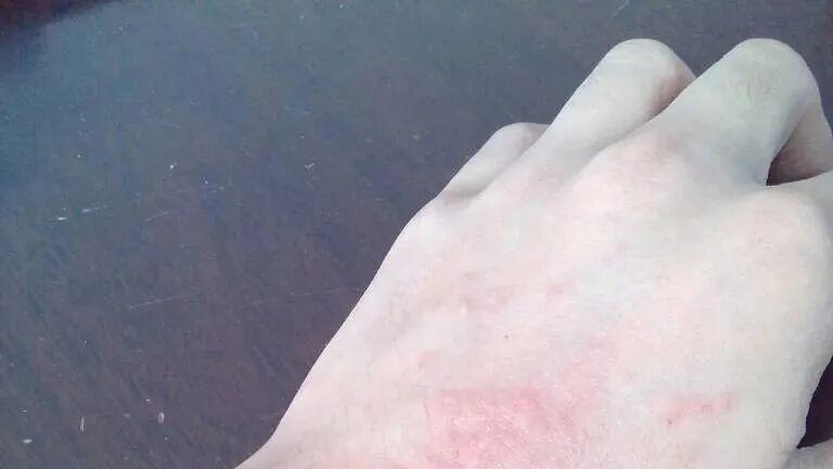 手镯修复选不对，镯子变b+c？伤害身体太遭罪！千万别因小失大！