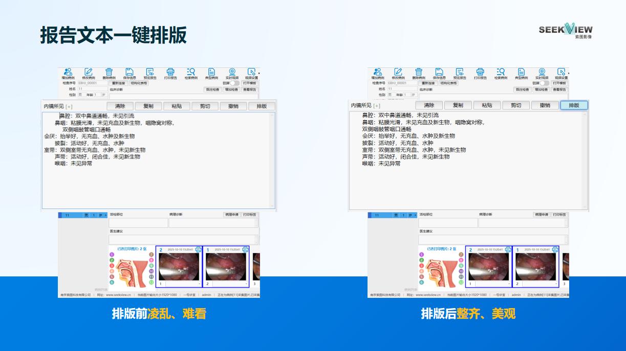 医学图文工作站5个高效功能，每天省下1小时