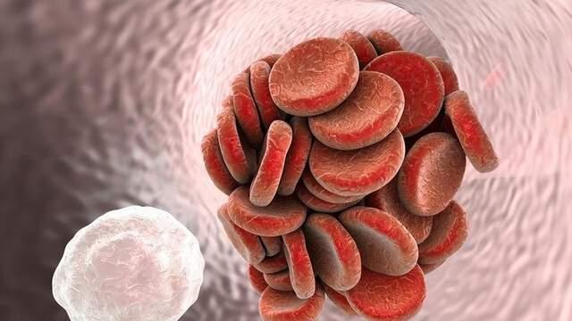 胸口闷心脏出问题了？小心动脉粥样硬化，别等血管出现症状才行动