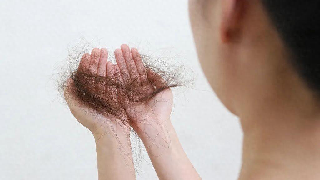 你的脱发焦虑，让这家公司赚了10亿