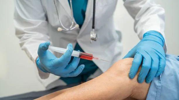 2025年临床新数据：502名患者证明干细胞治疗骨关节炎，显著缓解疼痛、改善关节功能