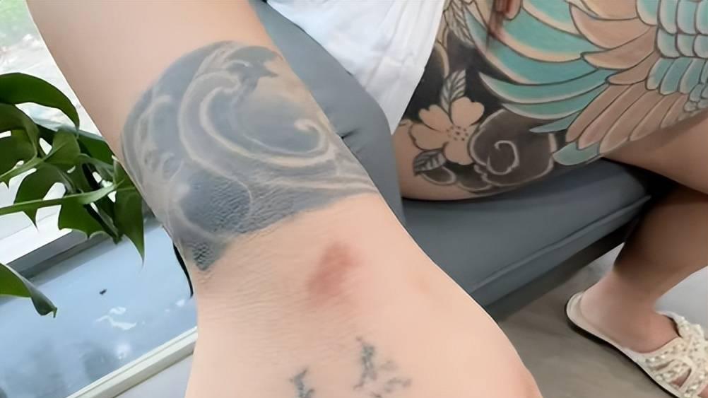 女孩为迎新生活忍痛清除满身情债，激光下的蜕变让人心疼又深思