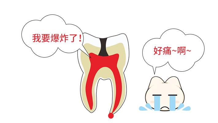 为什么牙齿疼着疼着就不疼了？是自愈了吗？