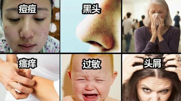 什么牌子的除螨仪家用性价比高？除螨仪家用床上哪个品牌好？权威测评出炉除螨仪十大品牌排行榜，闭眼入不踩