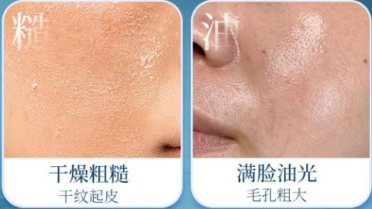 我的秋冬护肤爱用物分享 | 这瓶水帮我稳住了熬夜脸