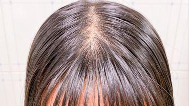 头发半天就油成条形码怎么办？实测儒曼洗发露控油蓬松，3分钟洗出高颅顶