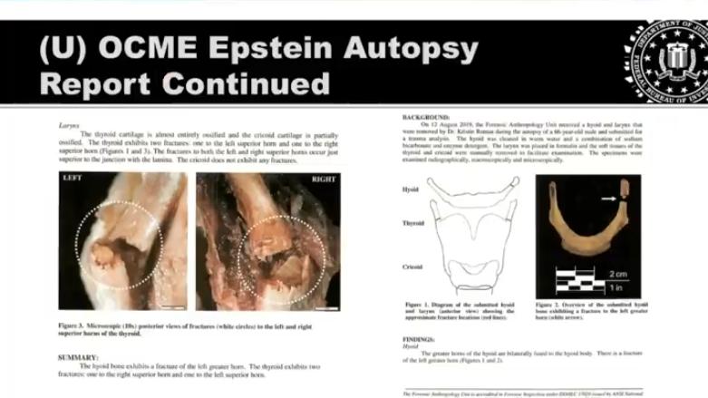 视觉冲击！爱泼斯坦狱中最后时刻照片流出，小道消息为何总能赢？