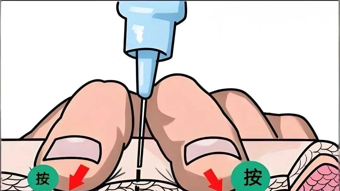 肌筋膜触发点：慢性疼痛的“幕后推手”