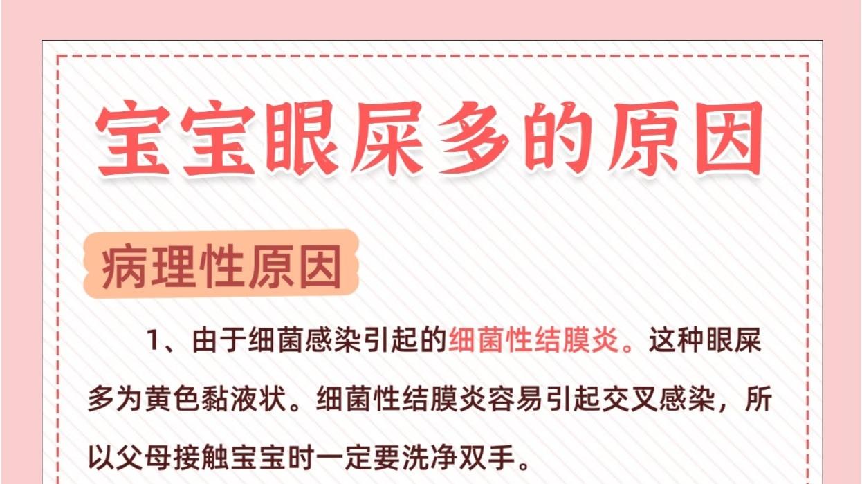 宝宝眼屎多？揭秘原因与清洁小妙招