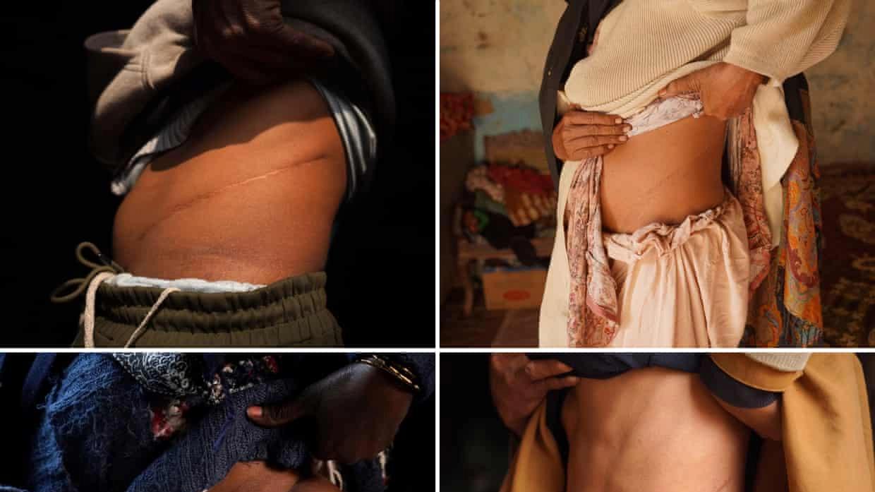 卖一颗肾，换不来自由，巴基斯坦砖窑债务奴役与非法器官贩卖