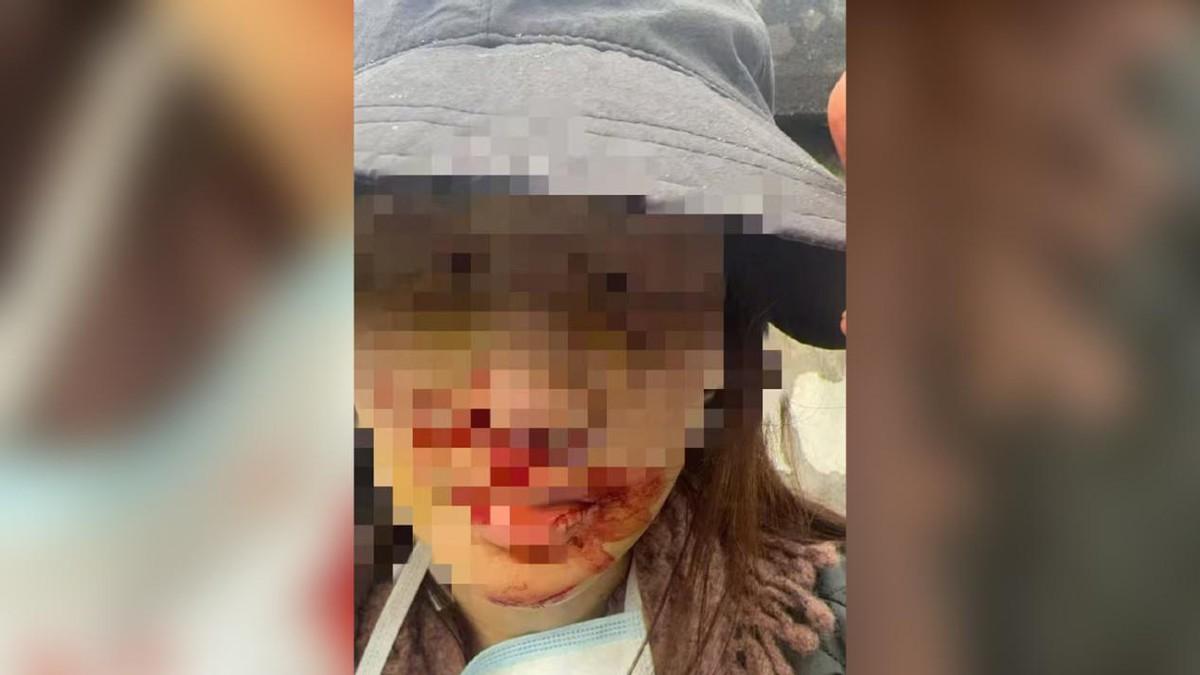 绍兴顶包案藏细节！律师谈金晨到底算不算肇事逃逸？