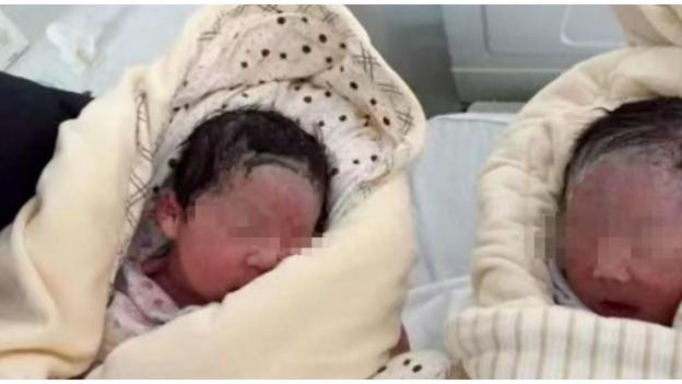 四川女子剖产龙凤胎后，自称腹中仍有物，医生查看后当场愕然。