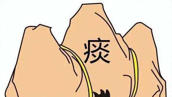 脂肪瘤从头到脚20多个，吃中成药不见小，老中医改方后包块变软