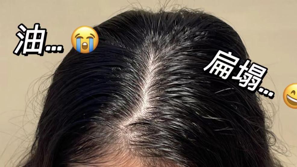 细软发质贴头皮严重哪款最能改善？儒曼控油蓬松洗发水，立体蓬松技术撑起整体发型