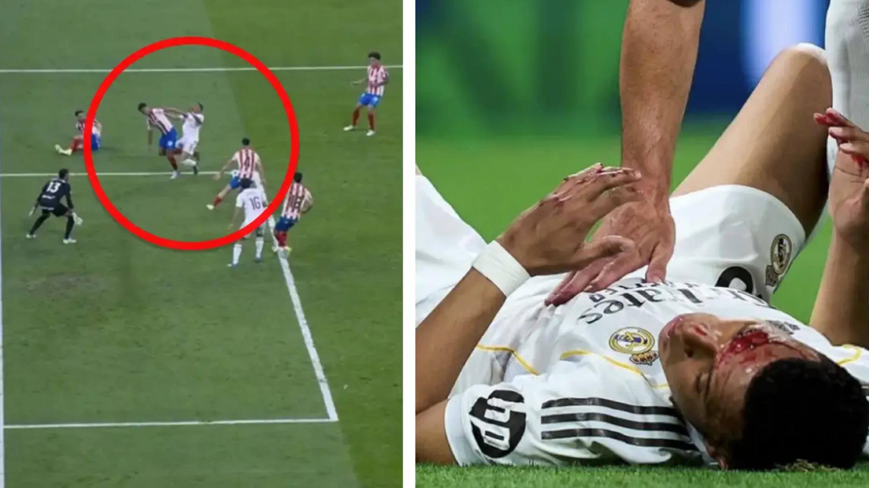 皇马1-1赫罗纳核心要点：多次漏判点球？楚阿梅尼欧冠替身二选一？