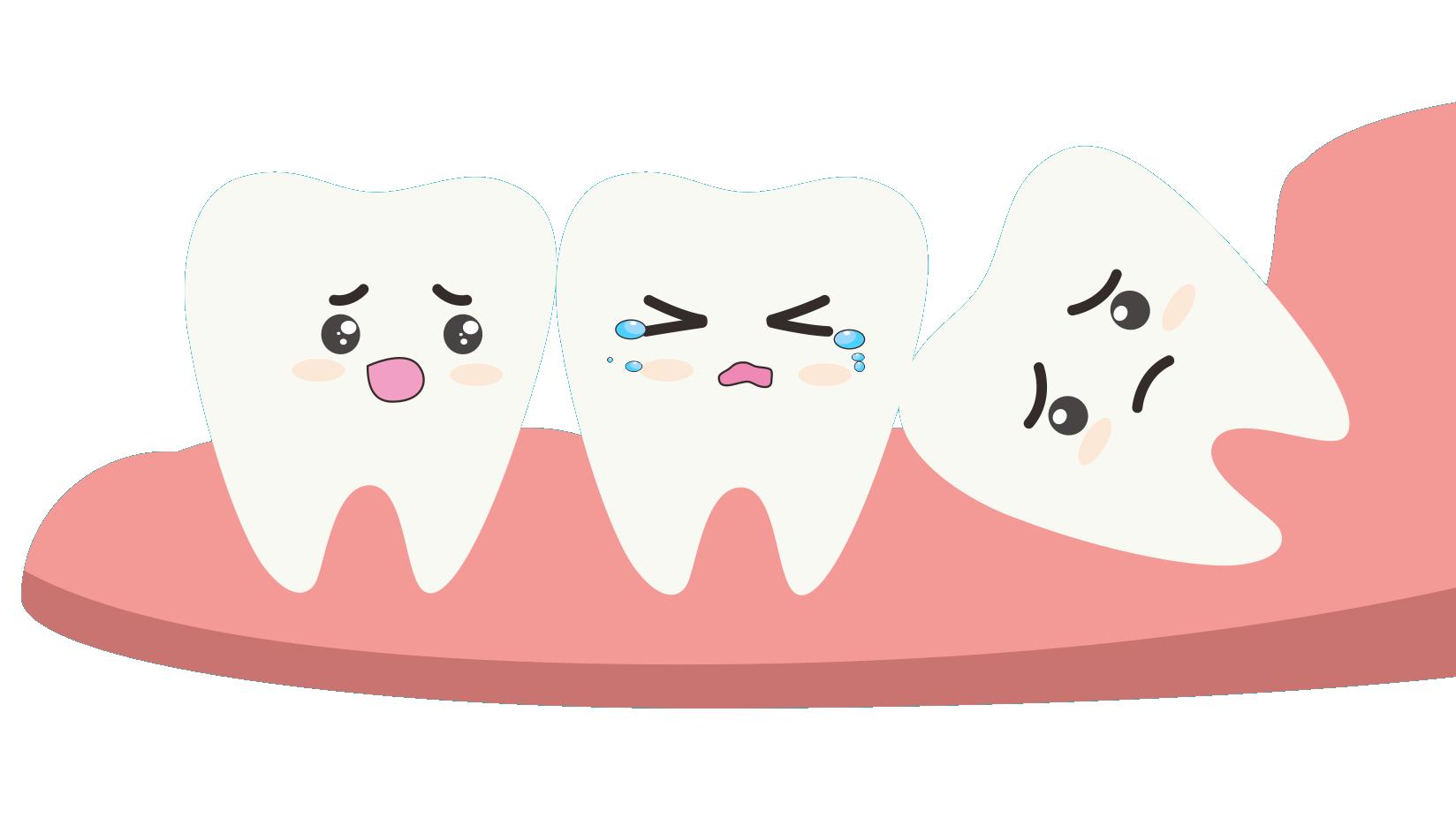 刚露头的智齿需要提前拔吗？一文说透拔与不拔的真相，建议收藏