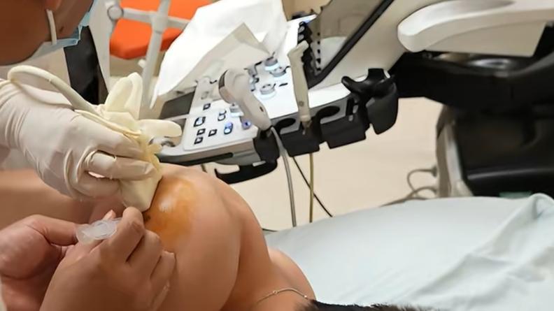 孙铭徽更新伤情！脚踝肩部一起治疗，坐轮椅离开，估计4月复出？