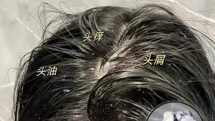 2026年度爱用分享 | 油头星人的10款控油蓬松洗发水自用测评