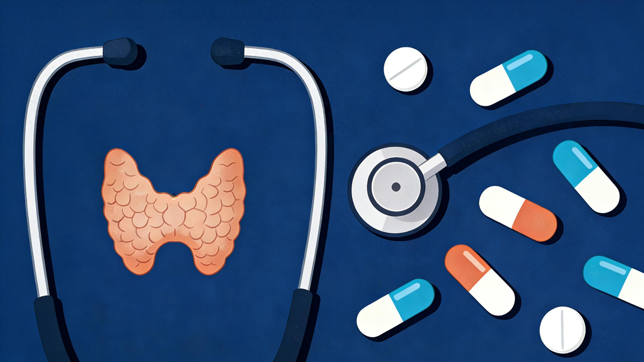 甲状腺功能减退症，如何安全有效地用药？