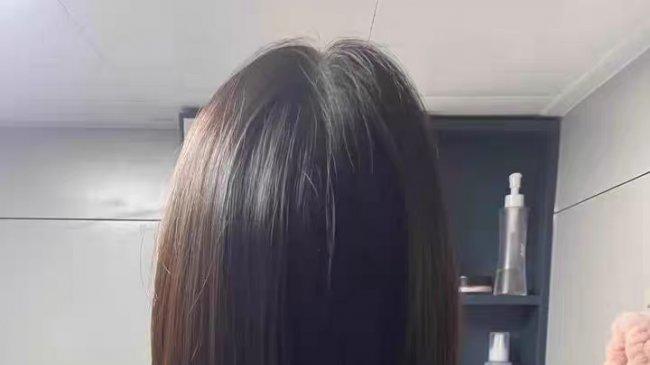2026头皮痒有头皮屑用什么洗发水？12款实测与全维度选购指南