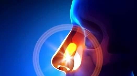鼻炎不治？忍忍就过去了？结果拖成鼻窦炎、哮喘，5个错误别犯了