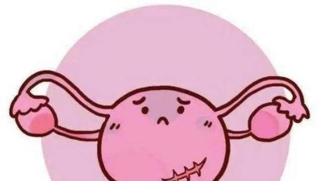 体检发现子宫肌瘤，要不要切？不一定，这5个误区别搞错了