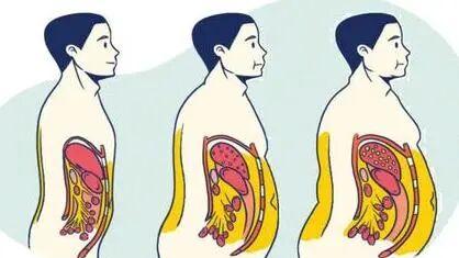 尿酸高，腰围也在偷偷涨？医学上叫“代谢性捆绑”，说明你离痛风只差一次“压垮”