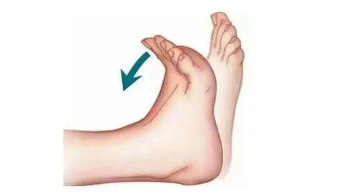 给尿酸安个“智能马桶”：一套“肾脏按摩操”+1杯“冲剂”，睡前做，晨起尿酸看得见的清