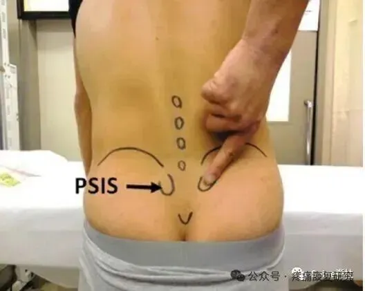 骶髂关节源性腰痛：从解剖到治疗