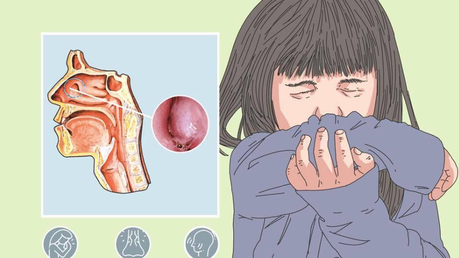 过敏性鼻炎久治不愈？你可能忽略了这些过敏原！