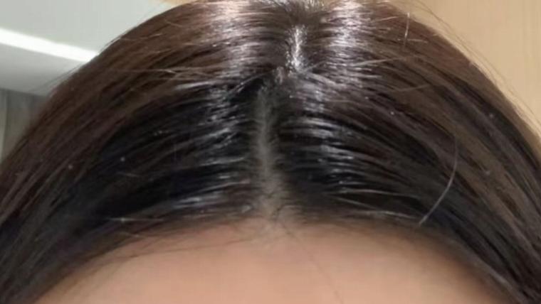 常年扎高马尾，我的油头有救了？聊聊最近在用的控油洗发水