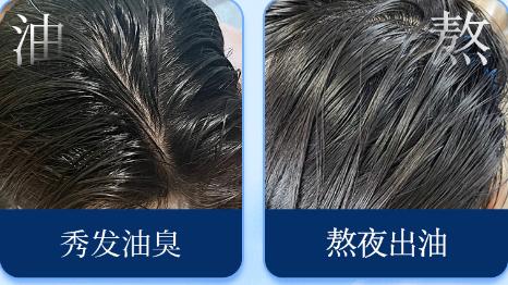 ​油头星人实测！用了这款洗发水，我的头皮终于能“呼吸”了