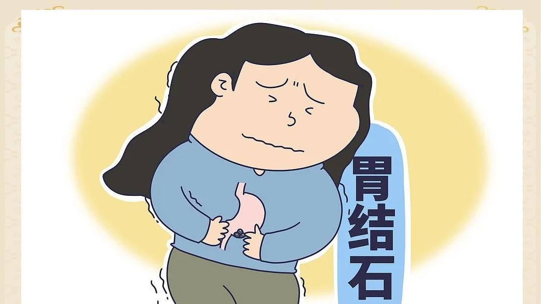胃结石不只是胃痛，是胃里长石头，出现上腹不适、呕吐，及时就医