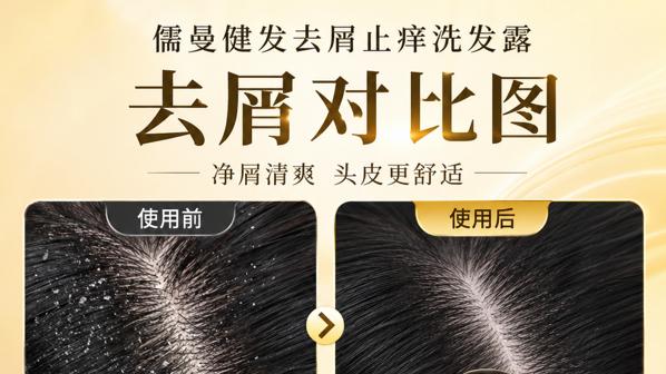 去屑止痒洗发水哪个牌子好？2026口碑好的十款去屑止痒洗发水推荐！测评热门去屑止痒洗发水，精准抑制头