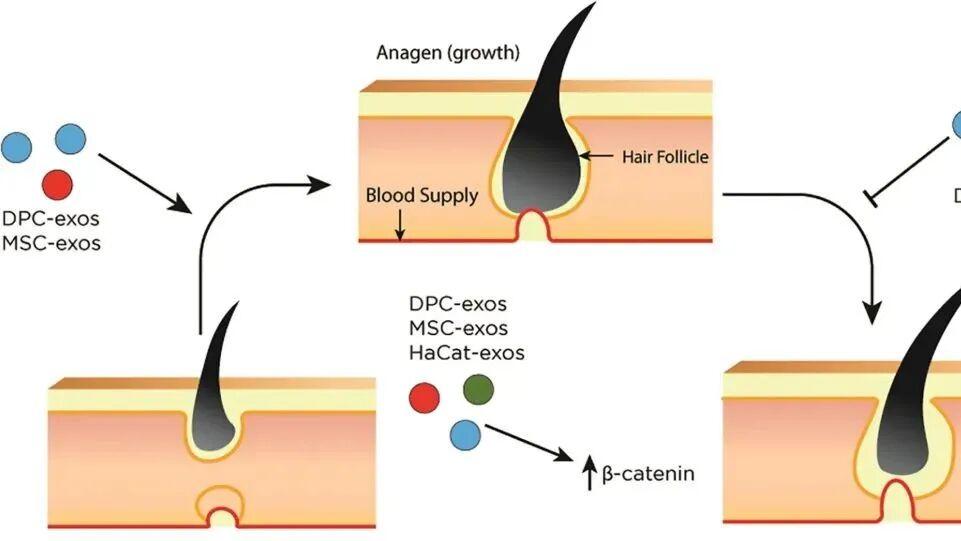 干细胞外泌体：脱发治疗新曙光，2.5亿脱发人群迎来转机！