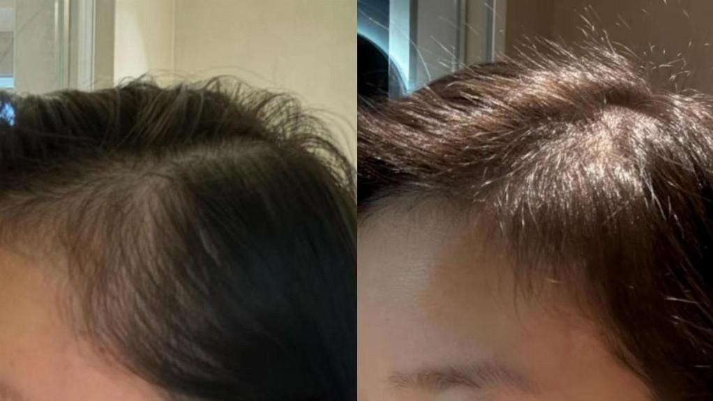 头皮刺痒、头屑多、发丝还干枯？分享我自用3个月的洗发水真实感受