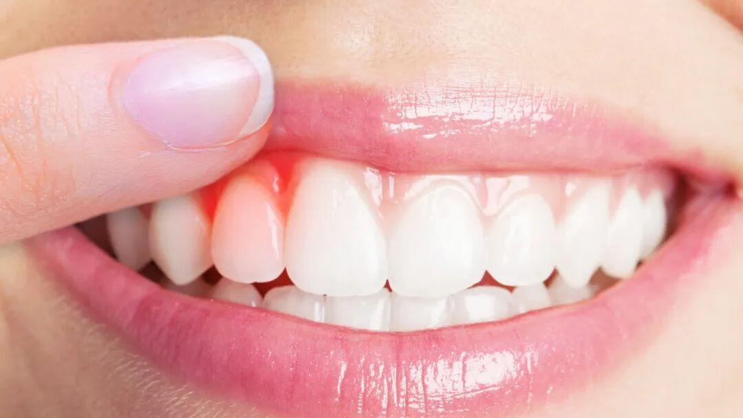 这份“降火指南”，温和不伤身