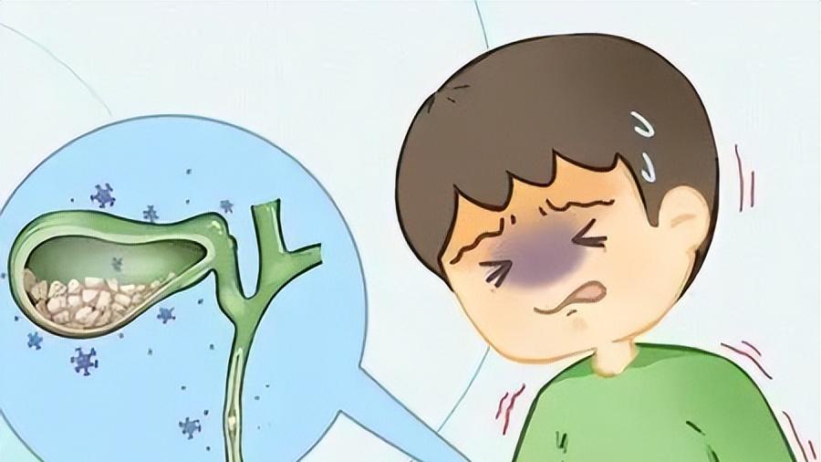 半夜右上腹剧痛，疼到直不起腰？别硬扛，可能是胆囊在报警